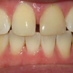 17_Upper Arch