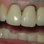 17_Upper Arch_0