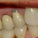 crowns1
